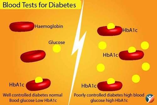 Diabetes Checkup 2 Test Services