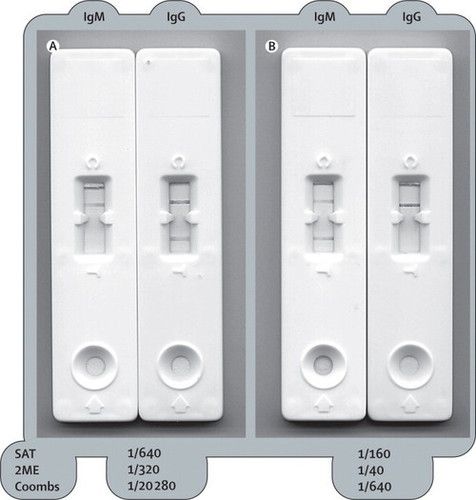 Brucellosis KIT (Brucella)