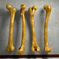 3D Femur बोन मॉडल