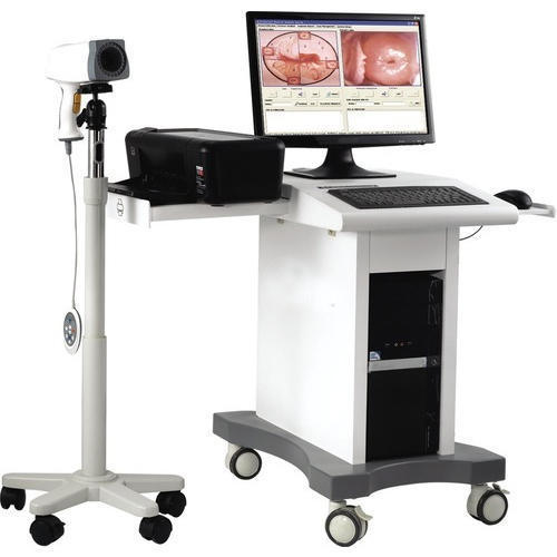 Electricl Digital Video Colposcope