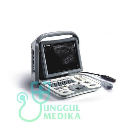 SonoScape A6V Veterinary Ultrasound Machine