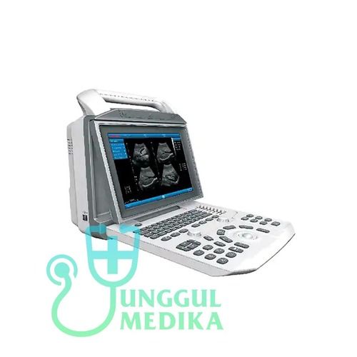 Risian Full Digital Bw Ultrasound Machine General Medicines