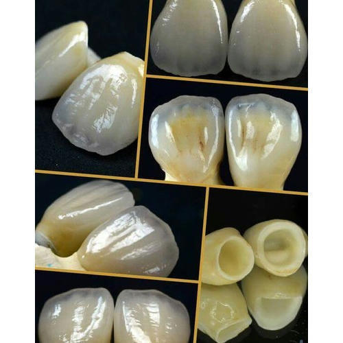 Zirconia Full Ceramic