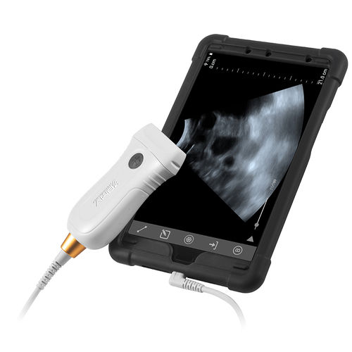 MX5 Portable Ultrasound System