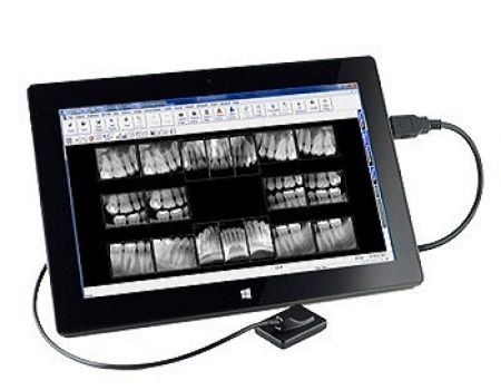 Suniray 2 Digital Intraoral Sensor Size 1 And Size 2 