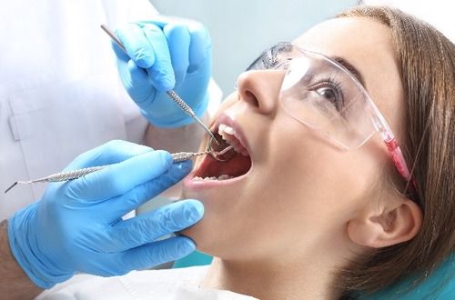 Wisdom Tooth Removal Service