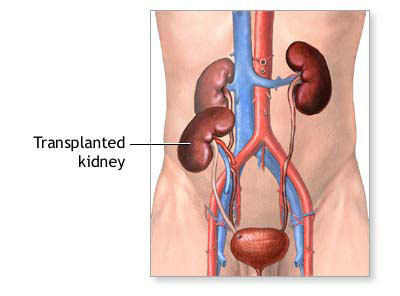 Renal Transplantation Treatment Services