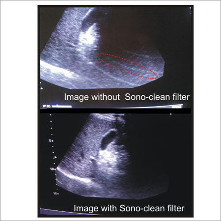 Emi Filter For Ultrasound Scanners