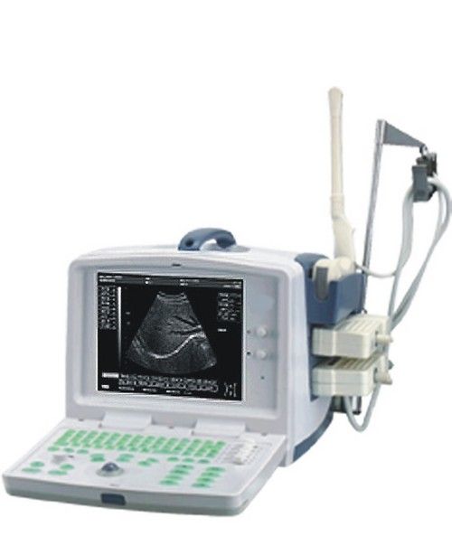 Digital Ultrasound Scanner - Portable Design, High-Precision Imaging | Easy Maintenance, Accurate Results, Simple Operation, Optimum Performance