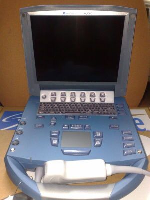 Frozen Color Doppler Ultrasound Scanner