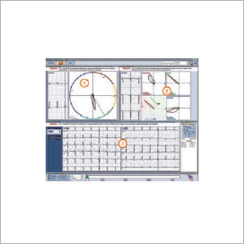 Holter Monitoring System