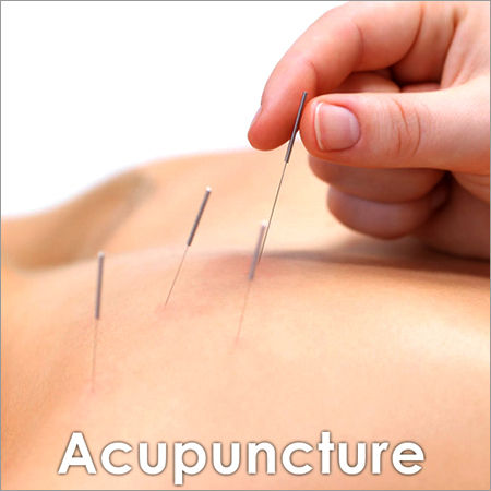 Acupuncture Therapies