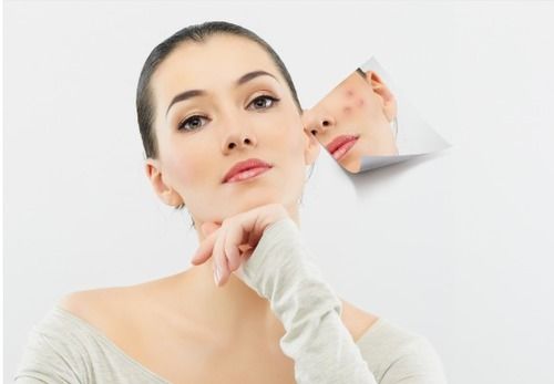 Acne Treatment Services