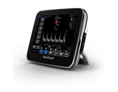 Chison Sonotouch 30 Portable Ultrasound System