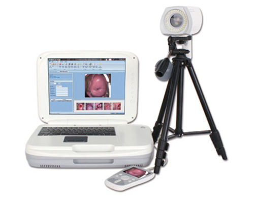 Ykd-3004 Portable Digital Colposcope Application: Hospital