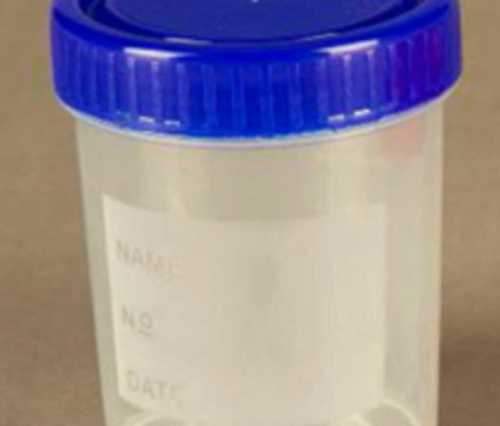 White Urine Collection Container