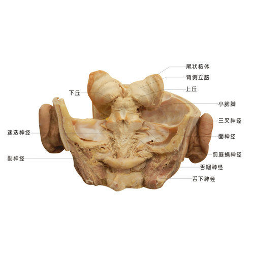 Human Skull Shows 12 Pairs Of Nerves Plastinated Specimen Roof Material: Metal Sheet