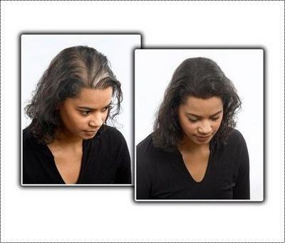 Black Color Ladies Hair Patch