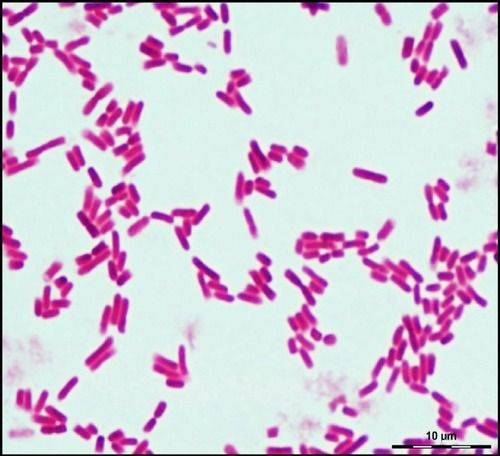 Nitrosomonas Eutropha By PRABHAT FERTILIZER & CHEMICAL WORKS