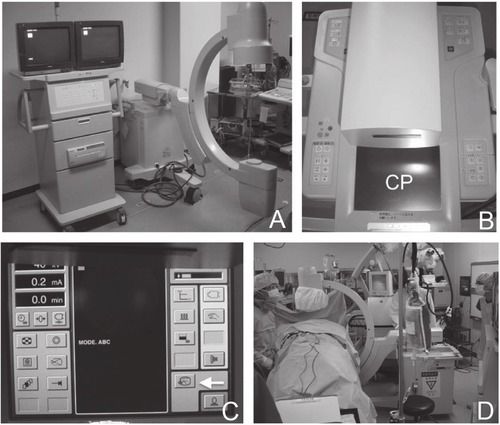 X Ray Apparatus - Digital Display, Automatic Mode | High Frequency Technology, Electric Power Source, Designed for Radiography in Healthcare Settings