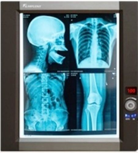 Single Panel Slim Led X Ray Viewer Usage: Viewing X-Ray