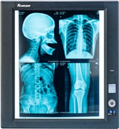 Single Panel Vertical High Bright Led X Ray Viewer Usage: Viewing X-Ray