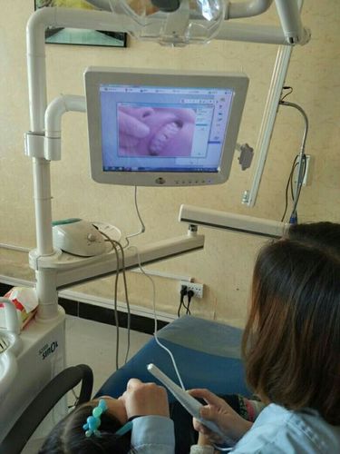 Intra Oral Camera With Monitor Wintel CPU Windows10 Touch Screen