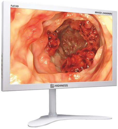 White 24 Inch Surgical Display Monitor Built-In Recording And Storage