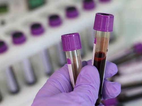 Coronavirus Test Tube - Plastic, Transparent | New Condition, Manual Operation, Electric Power Source
