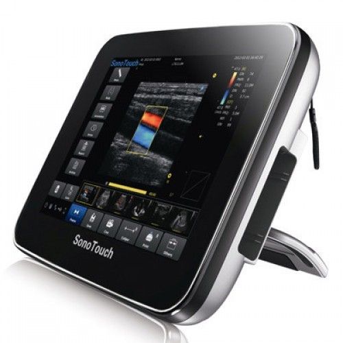 Chison Sonotouch 30 Ultrasound Machine