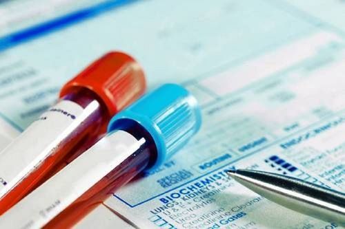 Repeated Dose 28-Day Oral Toxicity in Rodents Service