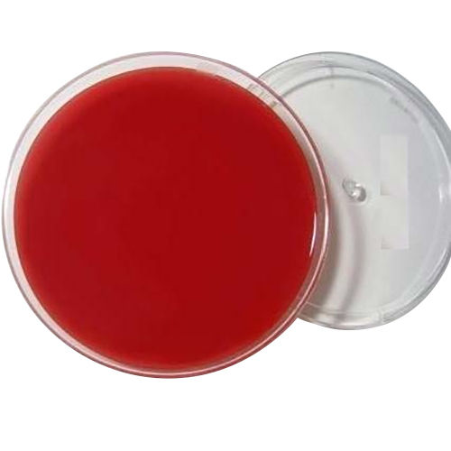 Sheep Columbia Blood Agar Plates