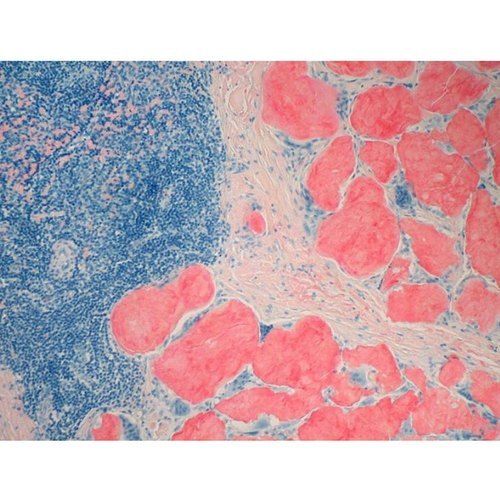 Ss004-25 Amyloid Congo Red Stain Kit Shelf Life: 2 Years