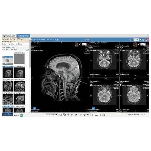 Picture Archiving And Communication System Software - 32 Bit, Java Programming Language, Single User License | In-Person Training, Backup Support, Remote Access, Electronic Image Integration, Lifelong Use