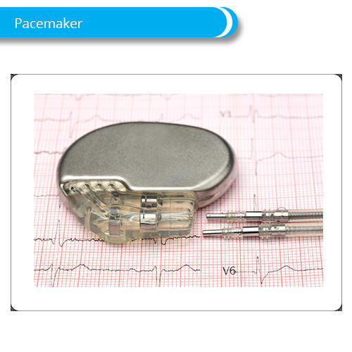 असामान्य हृदय लय को नियंत्रित करने में मदद करने के लिए अस्पताल का उपयोग कार्डिएक पेसमेकर 