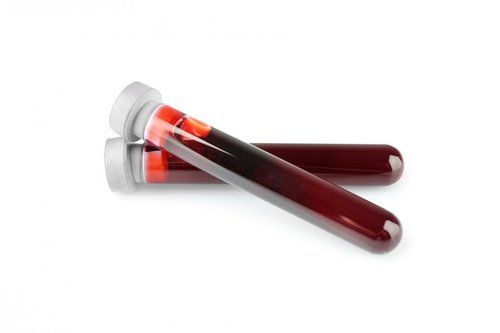 Cold Resistance Crack Proof Disposable Blood Collection Tube