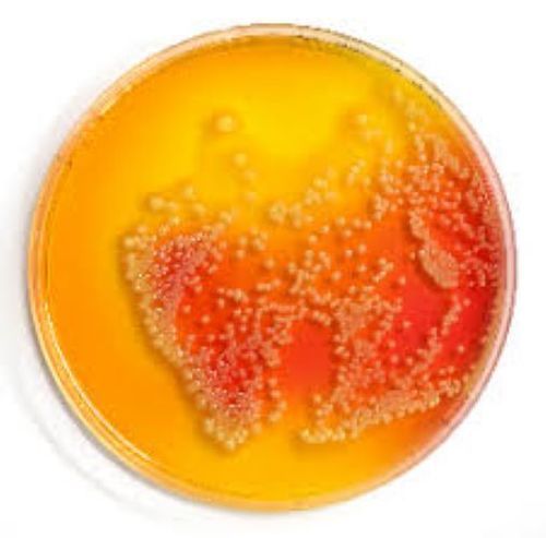 Salmonella Shigella Agar