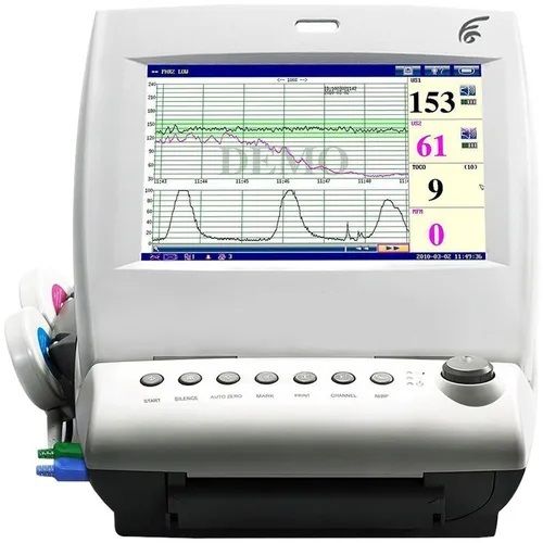 210bpm FHR Range and 10.1 Inch LCD Display Fetal Monitor with In-bult Thermal Printer