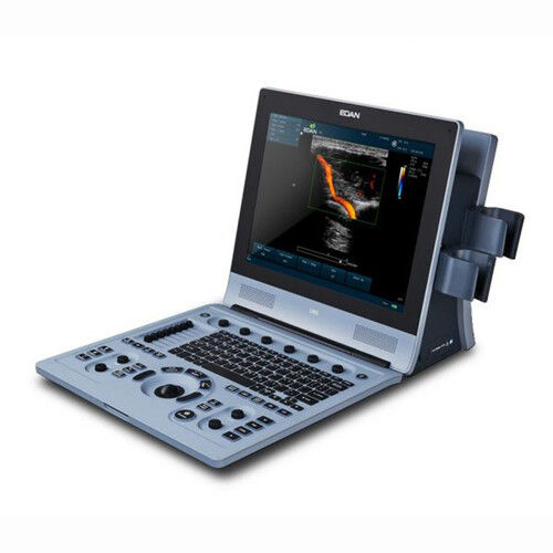 Portable U60 Diagnostic Ultrasound System, 15 Inch Screen Size