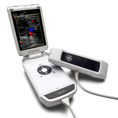 Ge Vscan With Dual Probe Ultrasound Machine