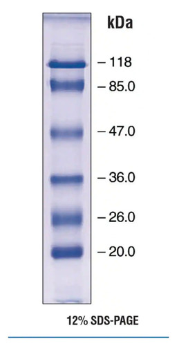 Protein Molecular Markers - Molecular Weight Range 6.5 to 260 kDa, Liquid Form with Blue, Orange, Green Stains for Hospital/Pathlab/Clinic Use