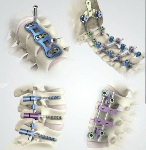 Spine Implants - Surgical Grade Precision Spinal Implants | Designed for Hospital Surgical Applications