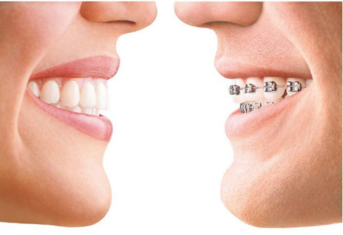 Orthodontics Dental Treatment Services