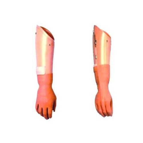 Upper Limb Prosthesis