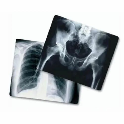 Dental X Ray Film For Dental Hospital