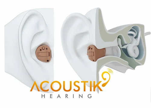 Unitron Moxi V3-R Hearing Aid