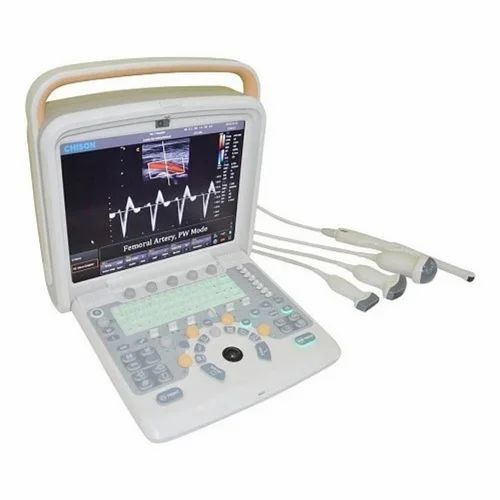 Refurbished Chison Doppler Ultrasound Scanner