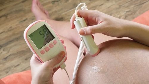 Fetal Doppler