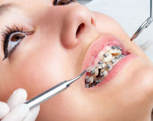 Dental Equipment Dental 
