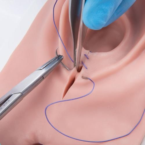 Skin Friendly Surgical Episiotomy Suturing Model